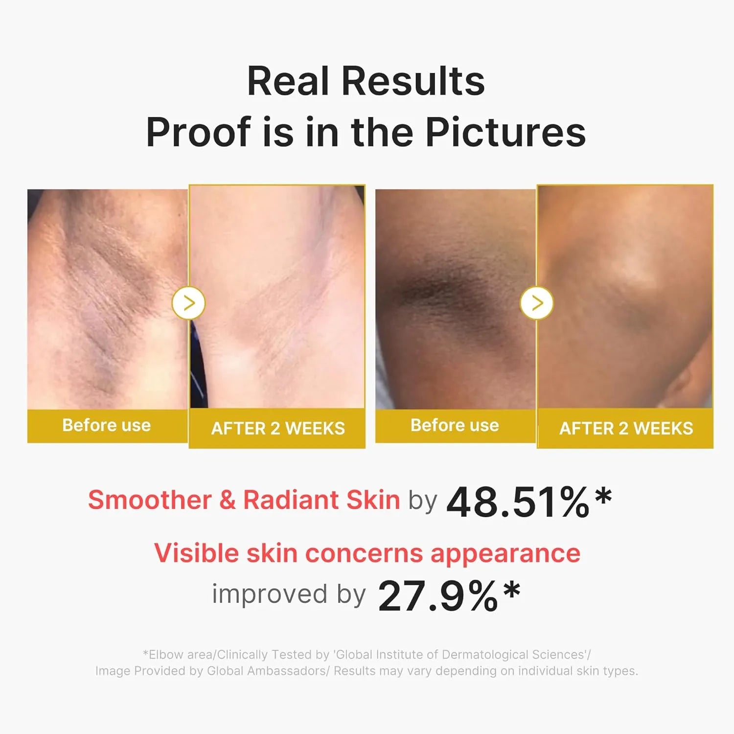 Kojic Acid Turmeric Body Peel Shot