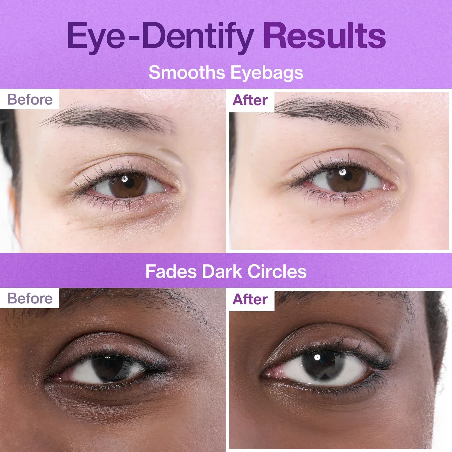 NO.9 Collagen Under Eye Patches (5 Pairs)